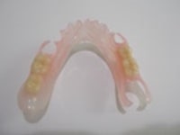 患者さんの口の中の型を取ります。お口の周りの筋肉をマッサージするようにして、患者さんのお口の中を正確に型どりをしていきます。