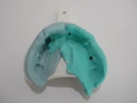 印象をもとに、模型を作ります。顎の骨と頬の境目がきれいに再現された模型が完成しました。完成した模型をもとに歯科医師と技工士で入れ歯の完成を話し合い、患者さんにご要望を反映させて入れ歯を作成します。