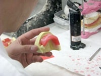 唇に触れる側の厚さを調整中。顎の骨と頬の境目がきれいに再現された模型が完成しました。完成した模型をもとに入れ歯を作成していきます。