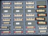 前歯の人口歯をお選びいただきます。患者さんにあった人工歯をじっくりと、前歯の形を20種類の中からお選びいただけます。