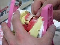 ロウ義歯を実際に入れて頂いているところ。歯科医と技工士、患者さんで見た目、咬み合わせを入念に確認します。