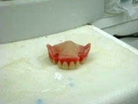 ロウ義歯最終調整。患者様に確認して頂いたロウ義歯を最終的に調整した状態です。