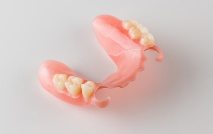 針金のバネを使用しない「入れ歯」